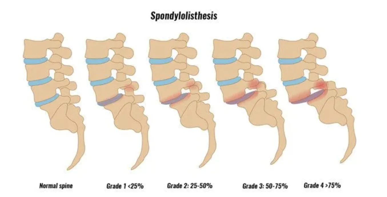 Primal chiropractic and fitness Blog's image