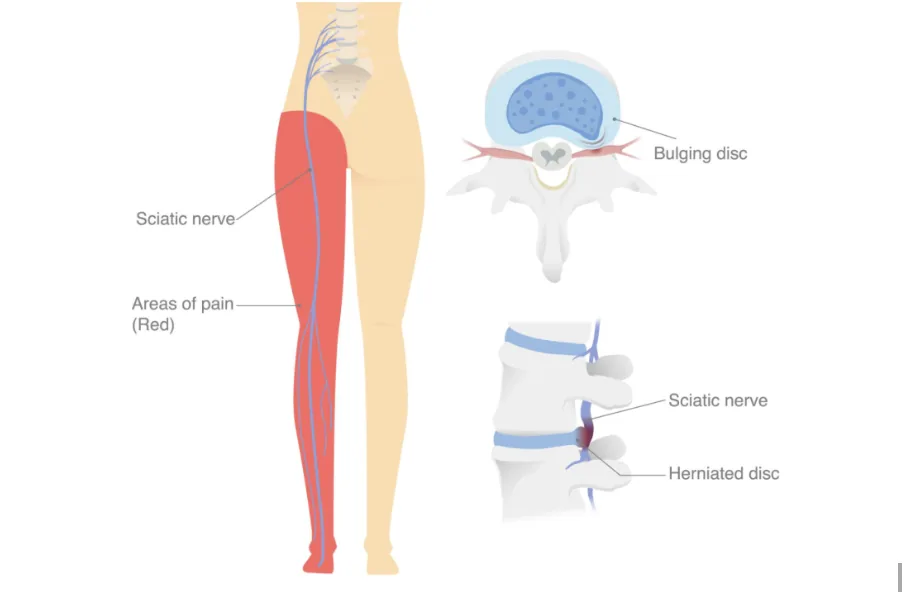Primal chiropractic and fitness Blog's image